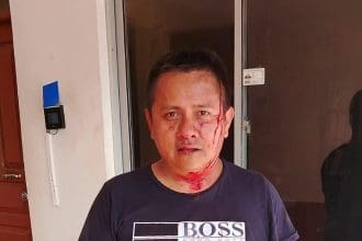 Fotografía cedida por Red de Ciudadanos de Mairana del periodista boliviano del canal Unitel Josué Chuvé que fue agredido por afines al expresdiente boliviano Evo Morales, el 29 de octubre de 2024, en la población de Mairana (Bolivia). EFE/ Red de Ciudadanos de Mairana