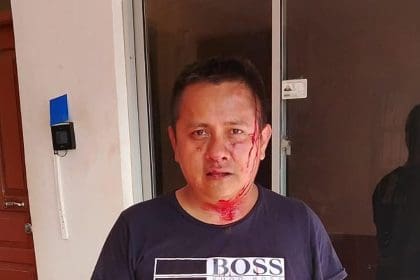 Fotografía cedida por Red de Ciudadanos de Mairana del periodista boliviano del canal Unitel Josué Chuvé que fue agredido por afines al expresdiente boliviano Evo Morales, el 29 de octubre de 2024, en la población de Mairana (Bolivia). EFE/ Red de Ciudadanos de Mairana