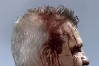 El técnico de la selección de México, Javier Aguirre, sale herido al recibir un impacto con un objeto que fue lanzada desde las graderías al finalizar el partido entre Honduras y México, en el Estadio Morazan, en San Pedro Sula (Honduras). EFE/STR